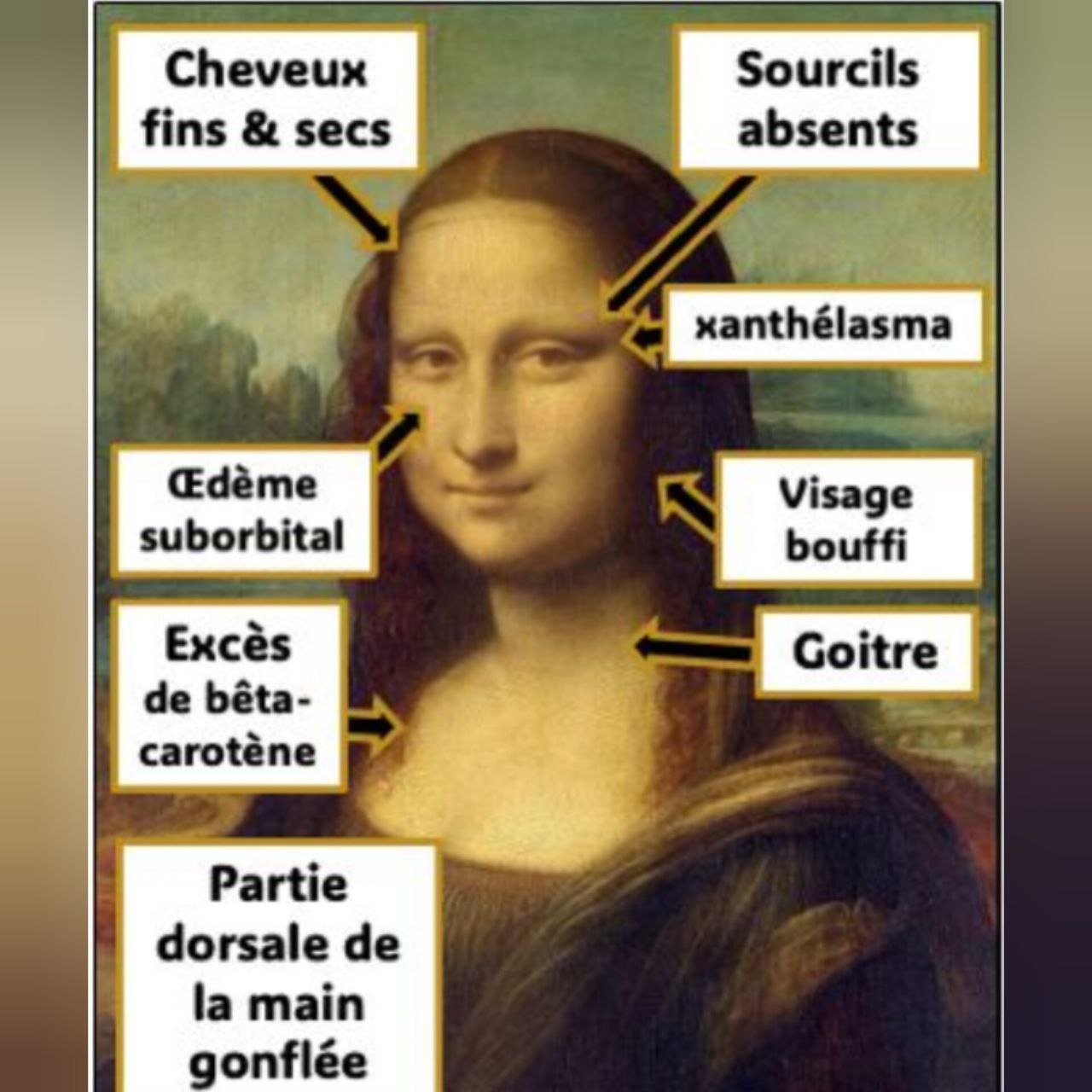 Tyroide: mode d'emploi