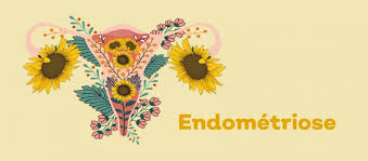 Comment réduire les symptômes de l'endométriose et des règles douloureuses?